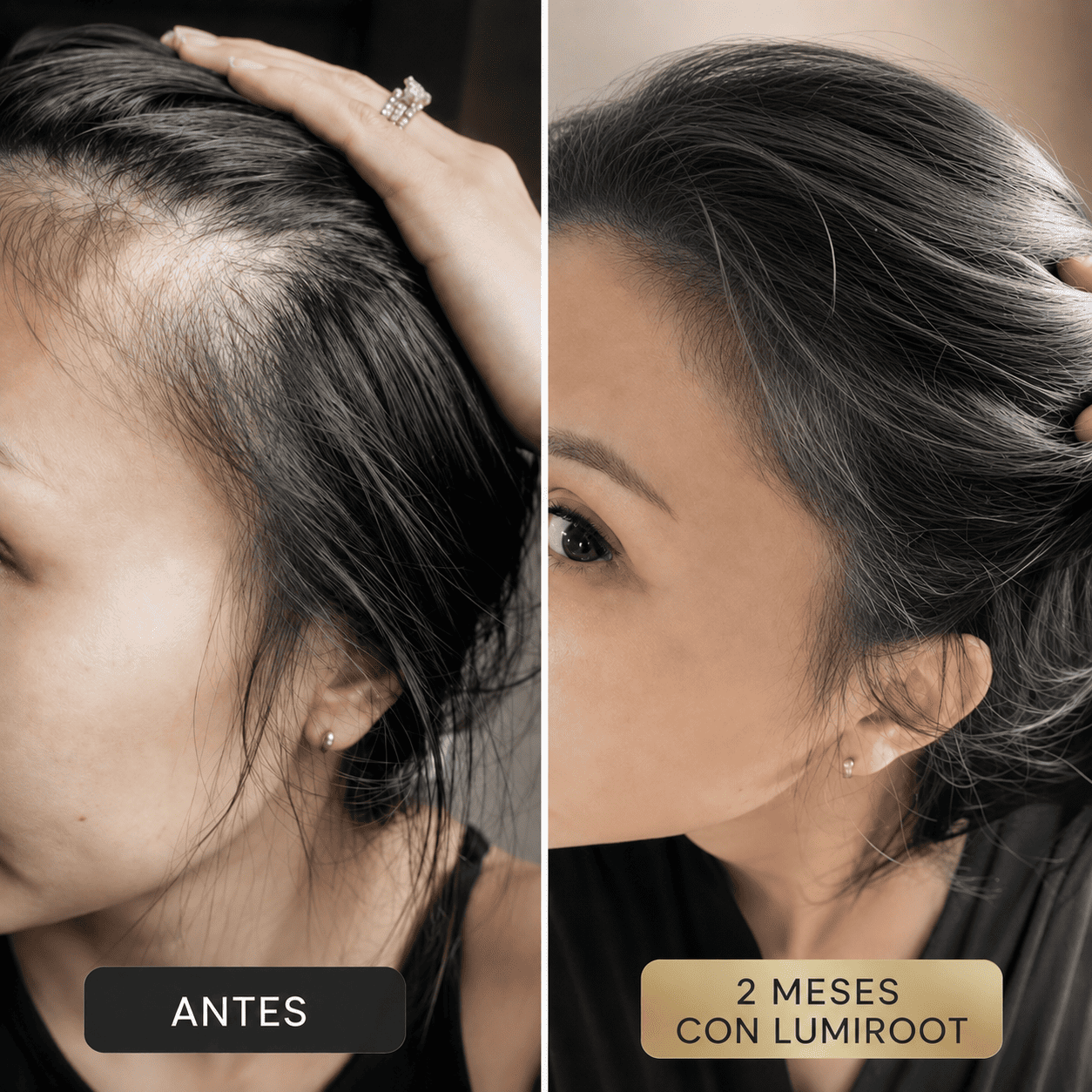 LUMIROOT™ | Estimulador de crecimiento capilar avanzado con luz roja