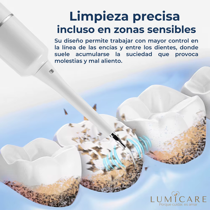 SonicClean Pro™ – Kit Dental Ultrasónico de Limpieza Profunda